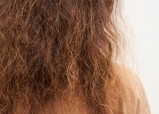 Damaged & Frizzy Hair